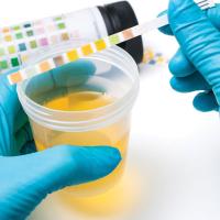 urine orange probation alcohol drug adult testing why